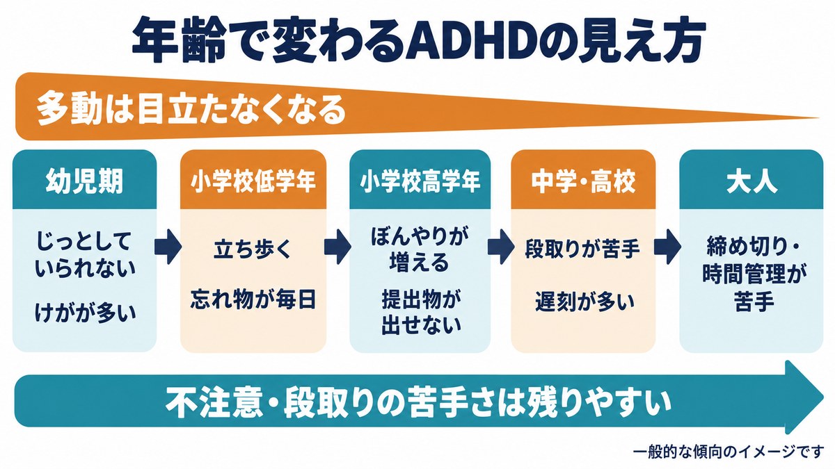ADHDの見え方が年齢で変わる様子のイメージ図。幼児期から大人にかけて多動は目立たなくなり、不注意や段取りの苦手さは残りやすい